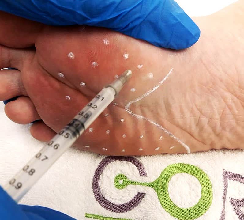 An injectable treatment being mapped out at Cormedicine